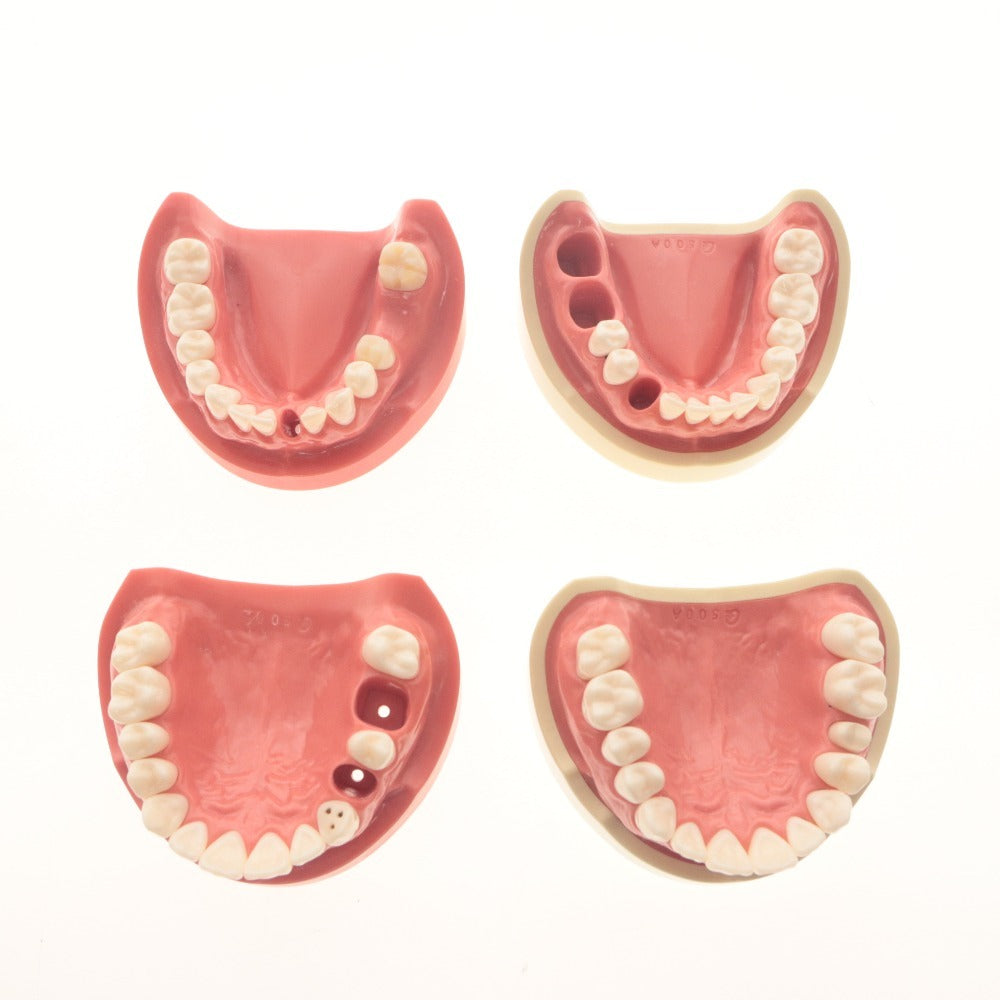 ■ Dental Supplies: Dental Models, Jaw Models, Rubber Cheeks, Plaster Models - Bulk Sale, Includes Surgical Training, Resin Teeth, Melamine Teeth, and Items with Boxes
